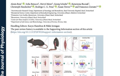 The Journal of Physiology The Journal of Physiology Research Article Open Access Massive reduction of RyR1 in muscle spindles of mice carrying recessive Ryr1 mutations alters proprioception and causes scoliosis